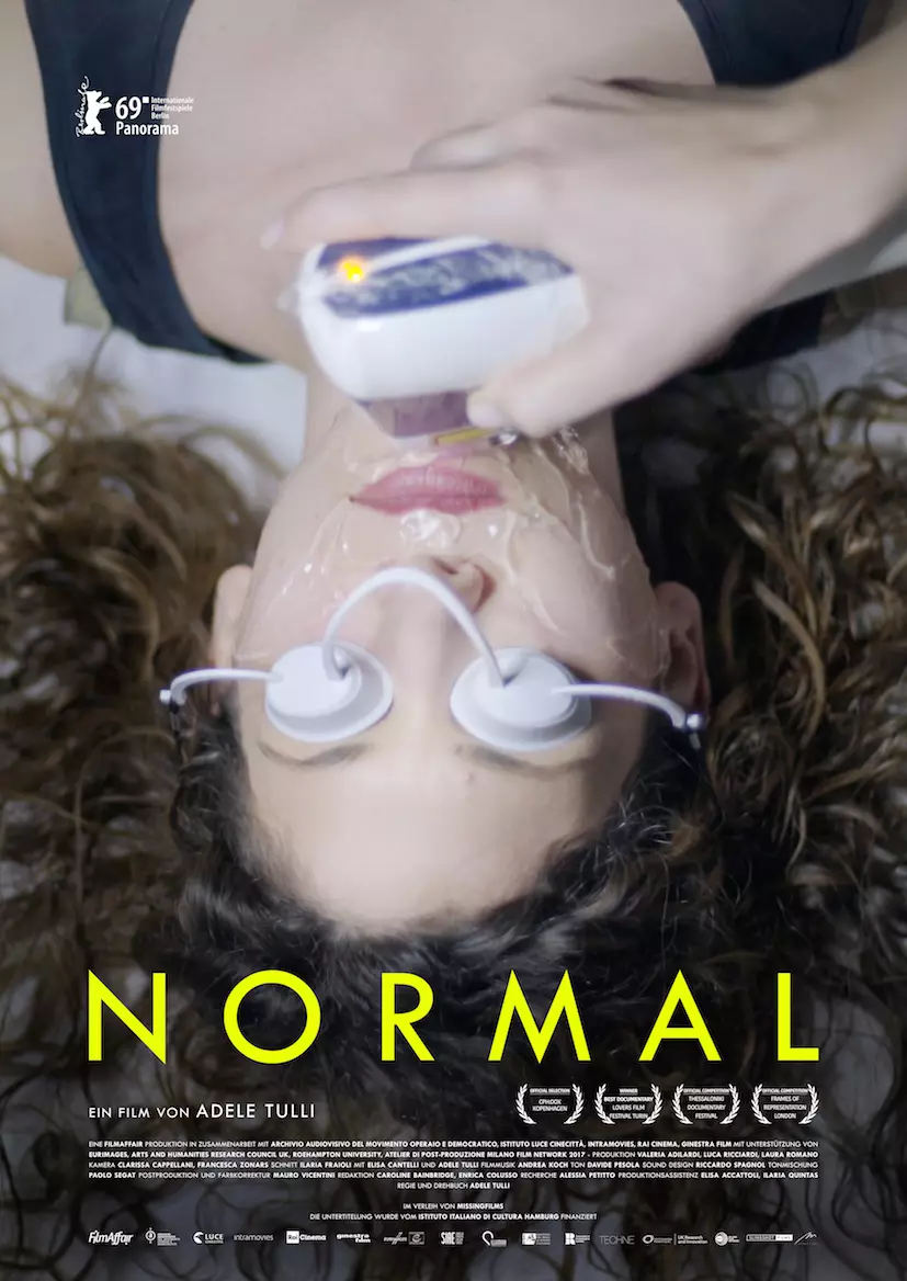 Normal